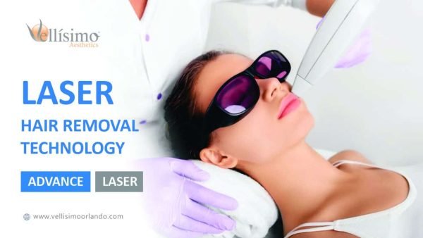 laser Hair removal in Orlando